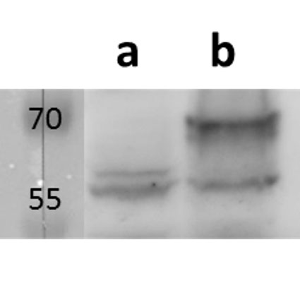 Anti-m155 (MCMV) antibody