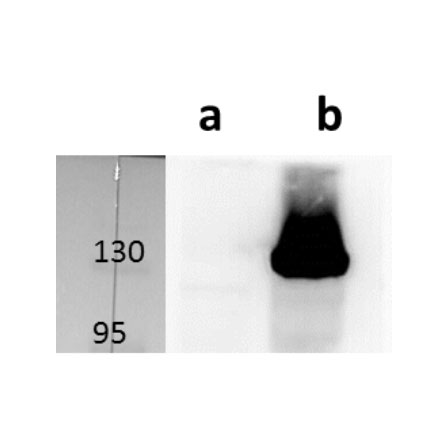 Anti-M45 (MCMV) antibody
