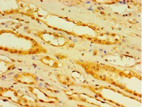 DCP2 Antibody