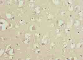 MAB21L1 Antibody