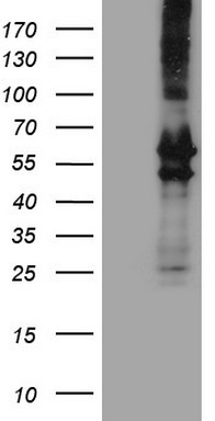 Macro H2A.2 (H2AFY2) antibody