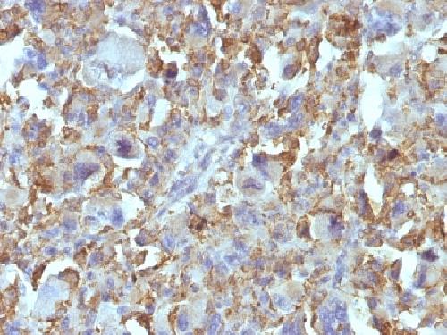 Macrophage & Histiocytoma Marker antibody
