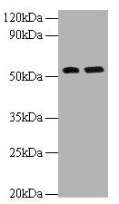 Macrophage metalloelastase antibody