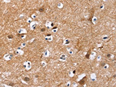 MAD1L1 Antibody