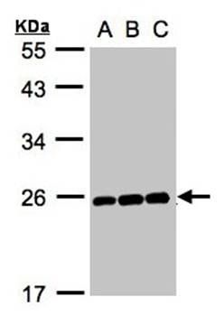 MAD2 antibody