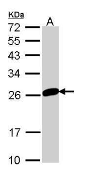 MAD2L1 Rabbit Polyclonal Antibody