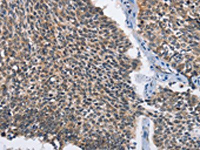 MAD2L1BP Antibody