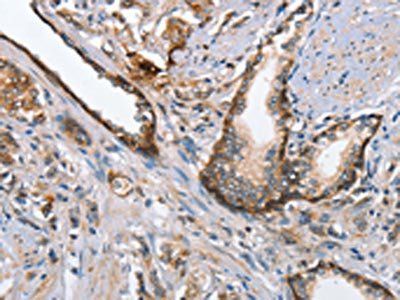 MAD2L1BP Antibody