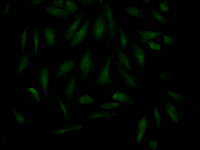 MAD2L2 Recombinant Monoclonal Antibody