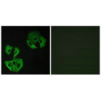 MADD Antibody