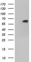 MADM (NRBP1) antibody
