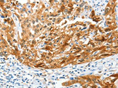 MAF Antibody