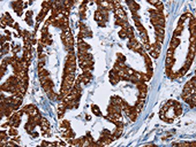 MAFF Antibody