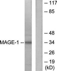 MAGE-1 antibody