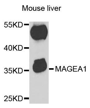 MAGEA1 antibody