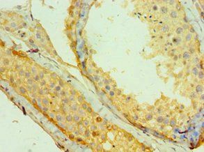 MAGEA1 Antibody