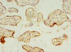 MAGEA10 Antibody
