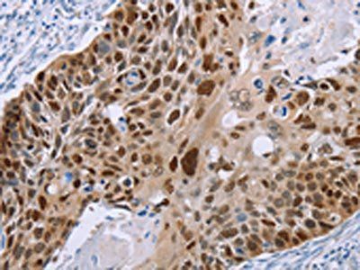 MAGEA10 Antibody