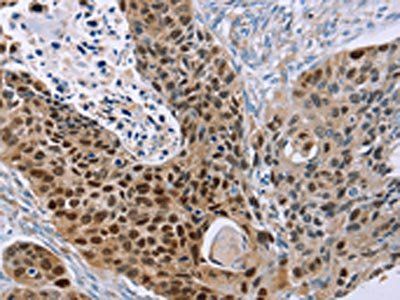 MAGEA10 Antibody