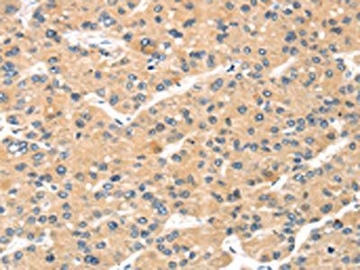 MAGEA11 antibody