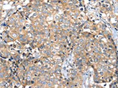 MAGEA11 Antibody