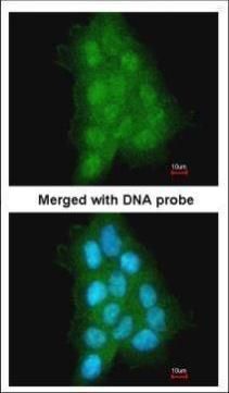 MAGEA11 antibody