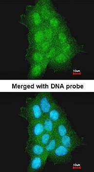 MAGEA11 antibody