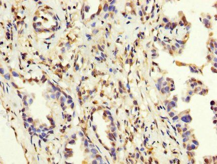 MAGEA3 Antibody