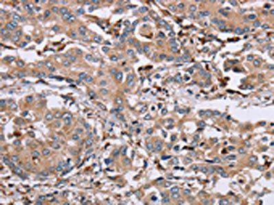 MAGEA3 antibody