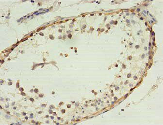 MAGEA4 Antibody