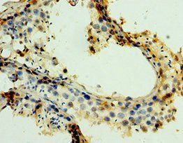 MAGEA6 Antibody