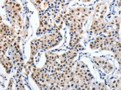 MAGEA6 antibody