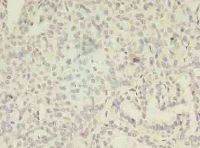 MAGEA8 antibody