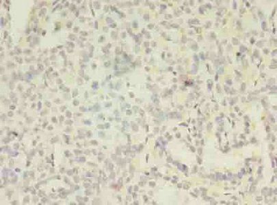MAGEA8 Antibody