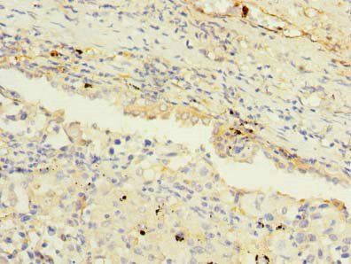 MAGEA9 Antibody