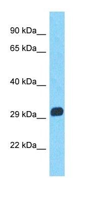 MAGEA9B antibody