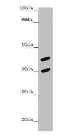 MAGEB10 Antibody