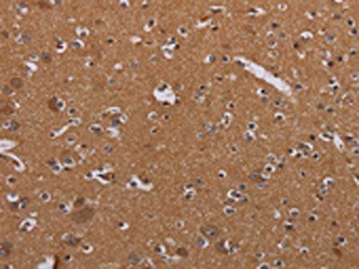 MAGEB10 Antibody