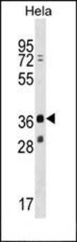 MAGEB16 antibody