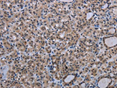 MAGEC1 antibody