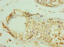 MAGEC2 Antibody