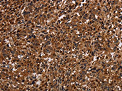 MAGEC2 Antibody