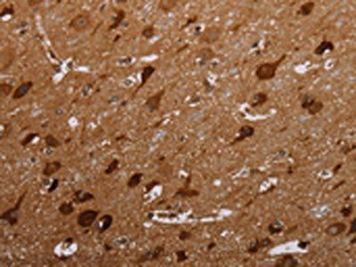 MAGEC2 Antibody