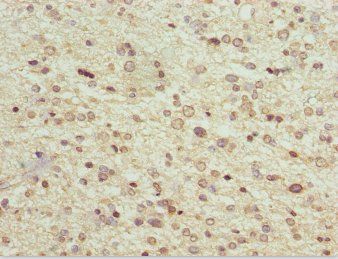 MAGED1 Antibody