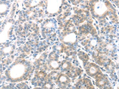 MAGED1 Antibody