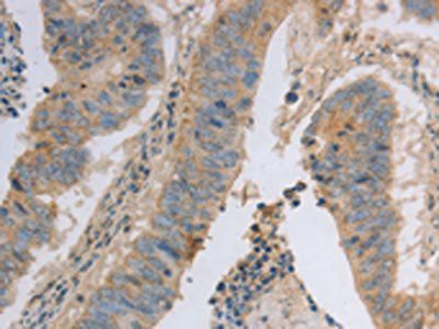 MAGED1 antibody