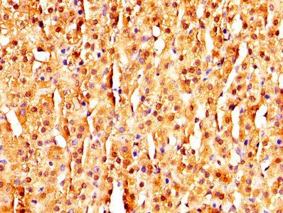 MAGED2 Antibody