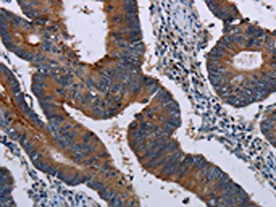 MAGEE1 Antibody