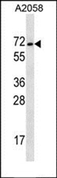MAGEE2 antibody
