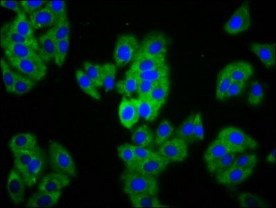 MAGI1 Antibody